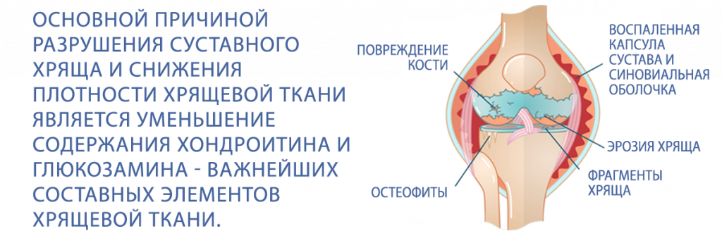 Артроцин